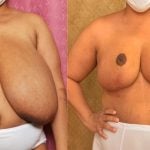 carlos luis leon recommends big saggy milf boobs pic